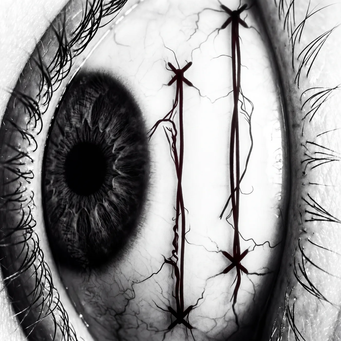 X-X-X-X — Iris