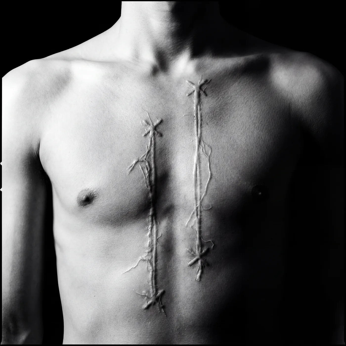 X-X-X-X — Sternum